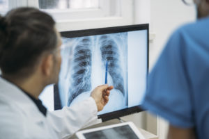 A doctor reviews a chest X-ray with a worker with silicosis 