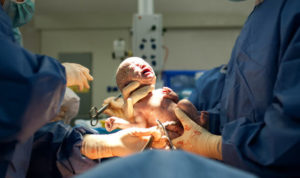 A doctor delivers a baby