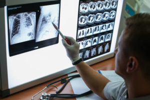 a doctor reviewing chest x-rays